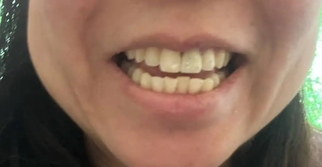Lakemont Family Dentistry