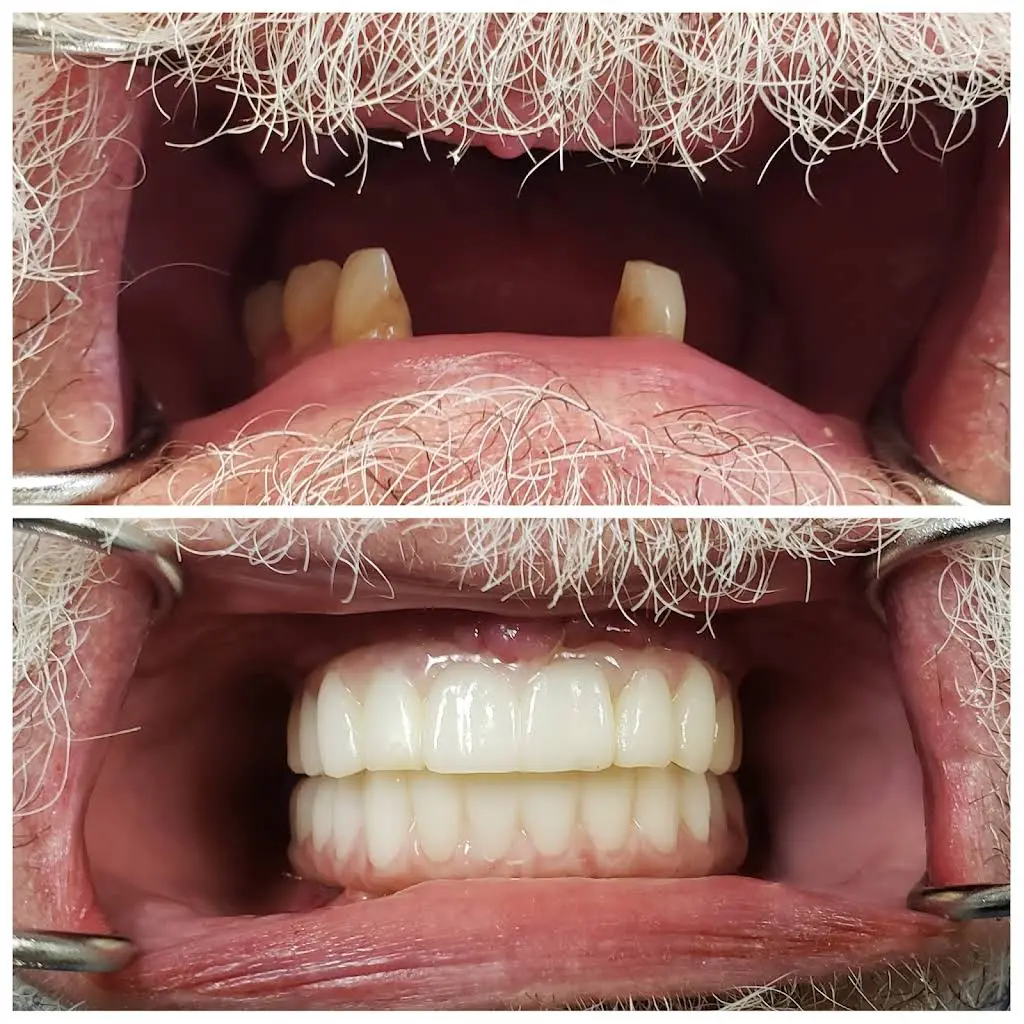 Complete Dental Care