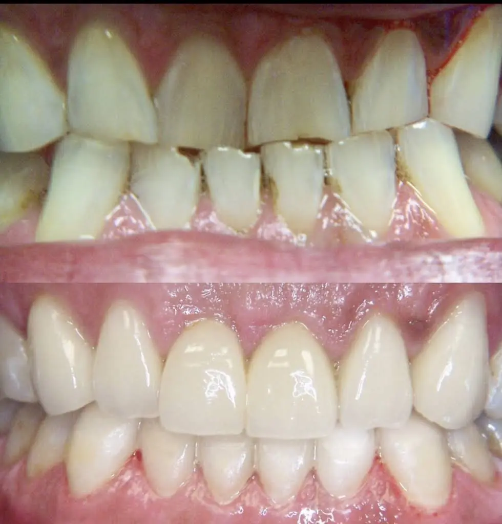 Everett Premier Dentistry
