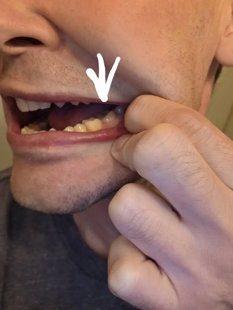 Everett Premier Dentistry