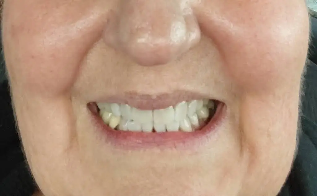 Everett Premier Dentistry