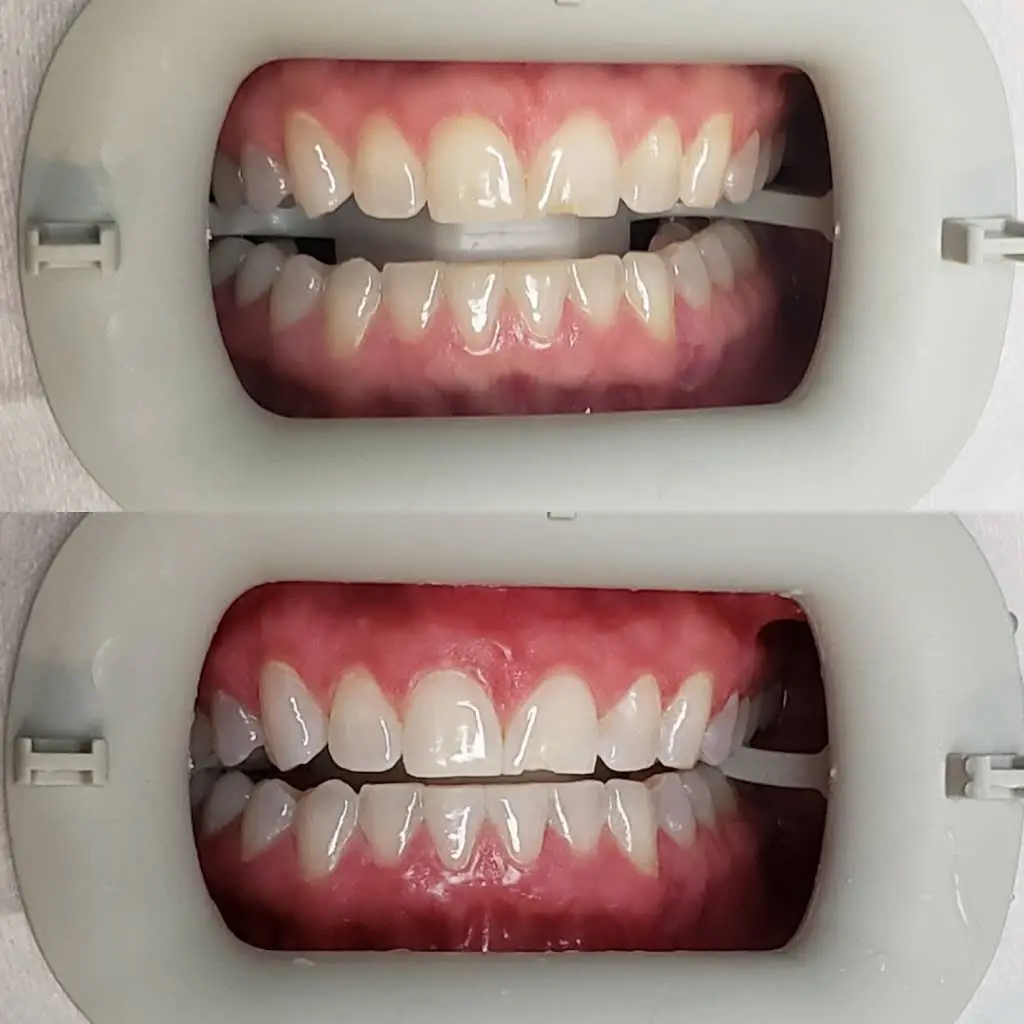 Covington Smiles
