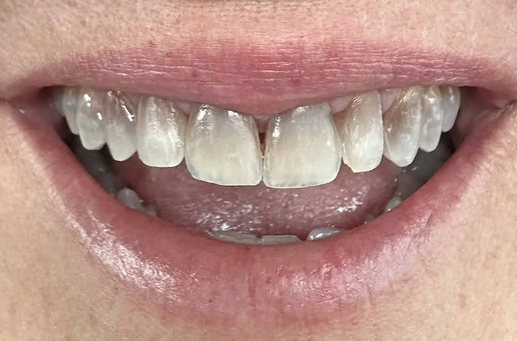 Covington Smiles