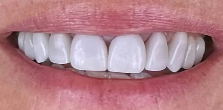 Covington Smiles