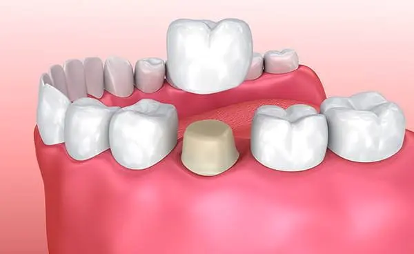 Complete Dental Care of Covington