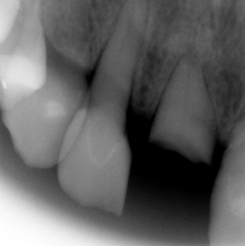 Family Dental Care - Dr. K Singh DDS