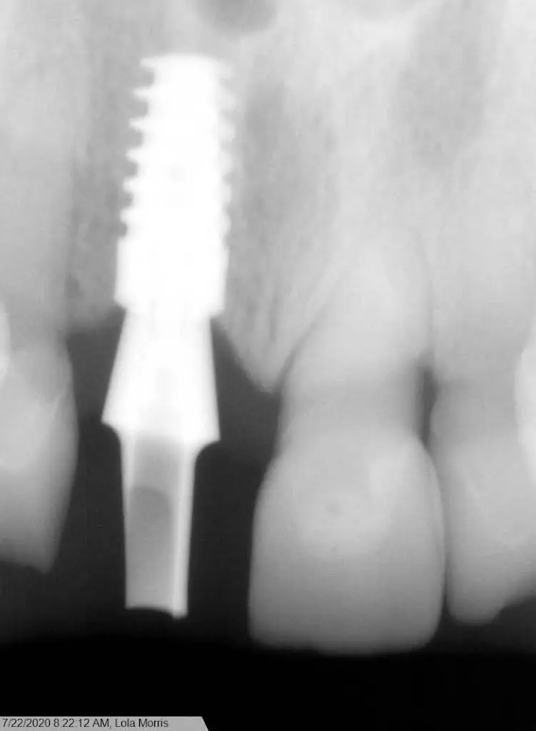 Family Dental Care - Dr. K Singh DDS