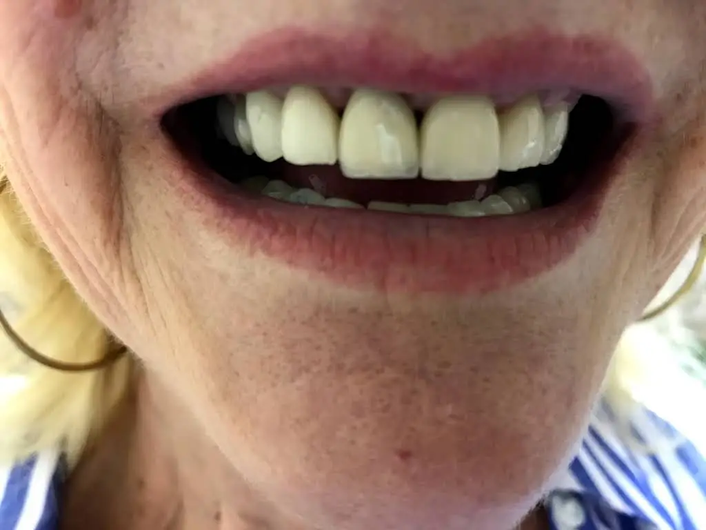 Family Dental Care - Dr. K Singh DDS