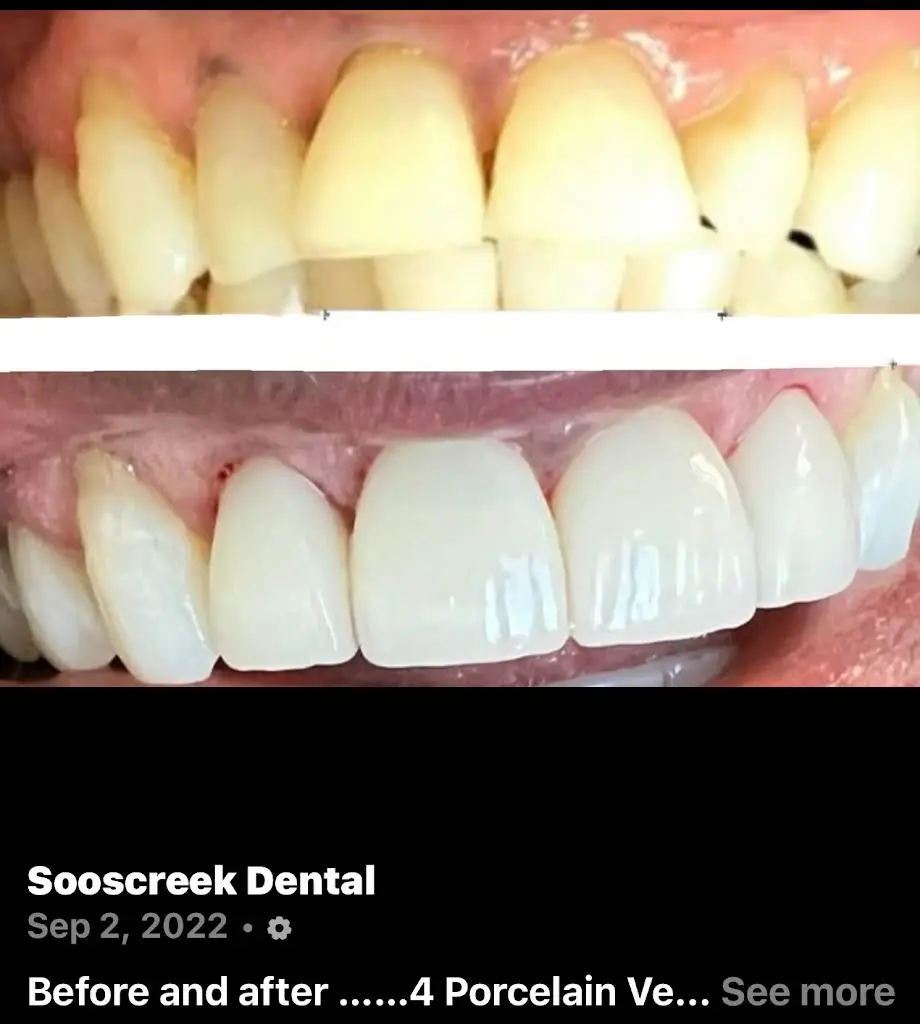 Soos Creek Dental