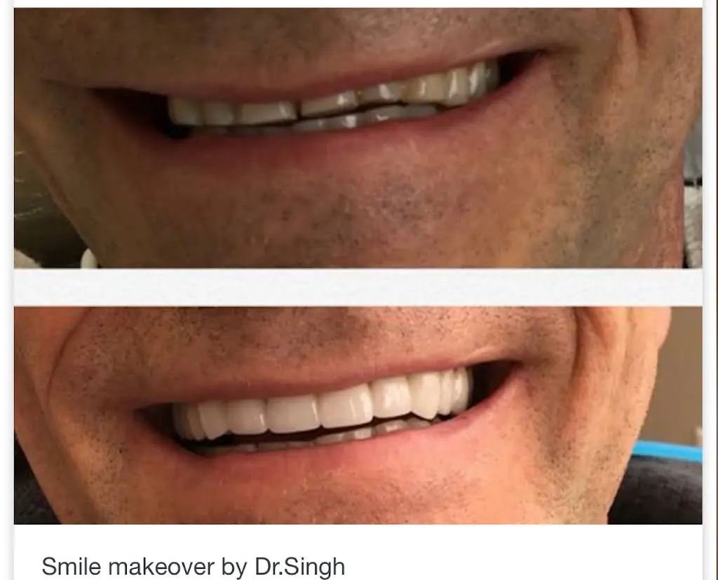 Soos Creek Dental