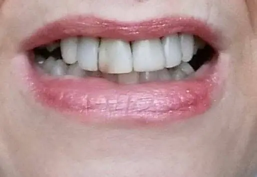 All Seasons Dental Care: Neal Wanner, DDS