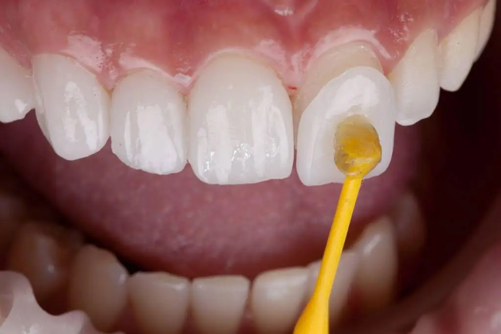 Northwest Family Dental Care
