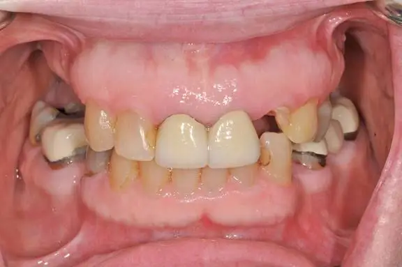 Bay Lakes Center for Complex Dentistry - Escanaba