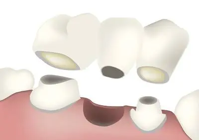 Bay Lakes Center for Complex Dentistry - Escanaba