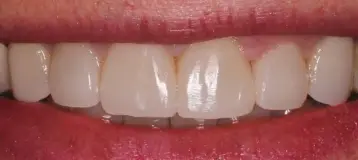 Lakeland Dental Care