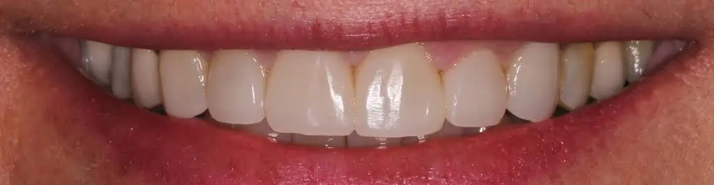 Lakeland Dental Care