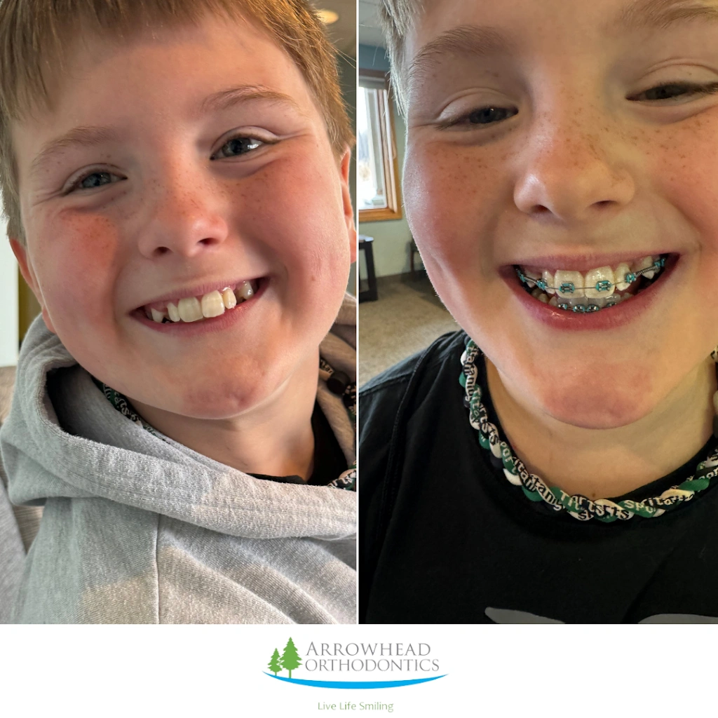 Arrowhead Orthodontics