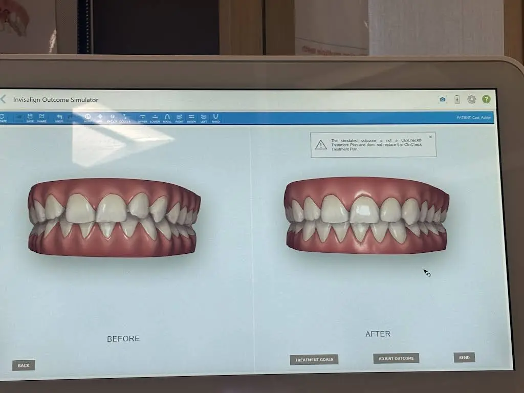 Aspen Dental