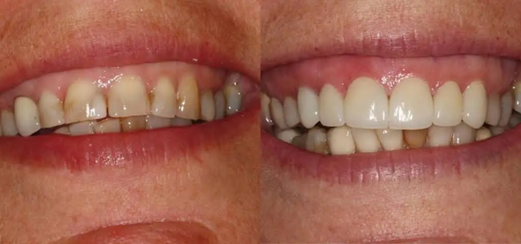 Lakewinds Dental Centre