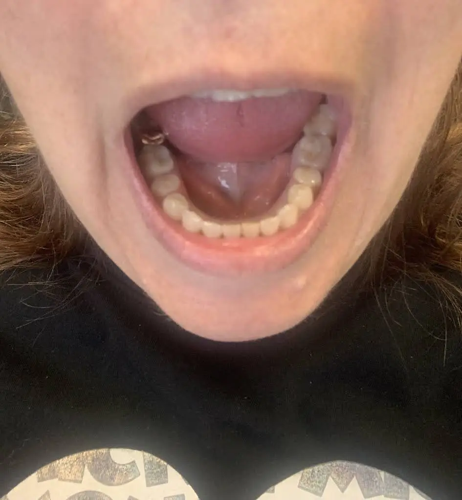 Great Lakes Dental Care