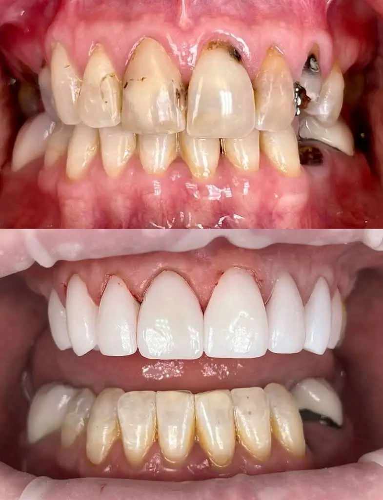 NorthPointe Family Dental & Implant Center