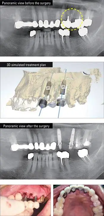 NorthPointe Family Dental & Implant Center