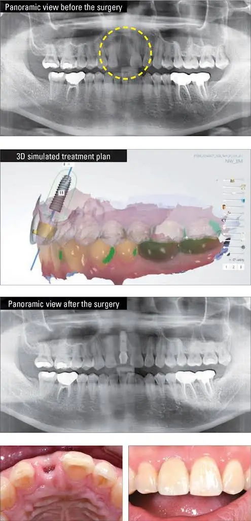NorthPointe Family Dental & Implant Center