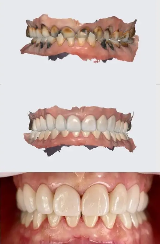 NorthPointe Family Dental & Implant Center