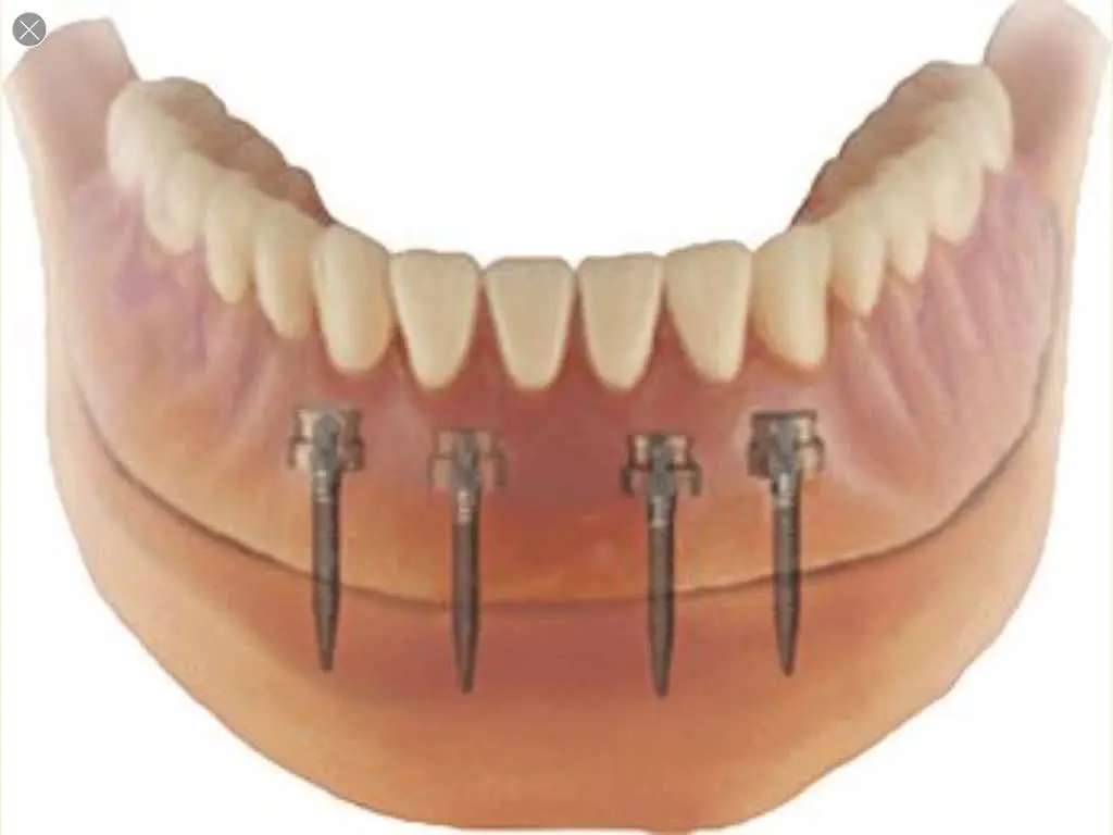 Park View Family Dentistry | Jennifer Larson DDS