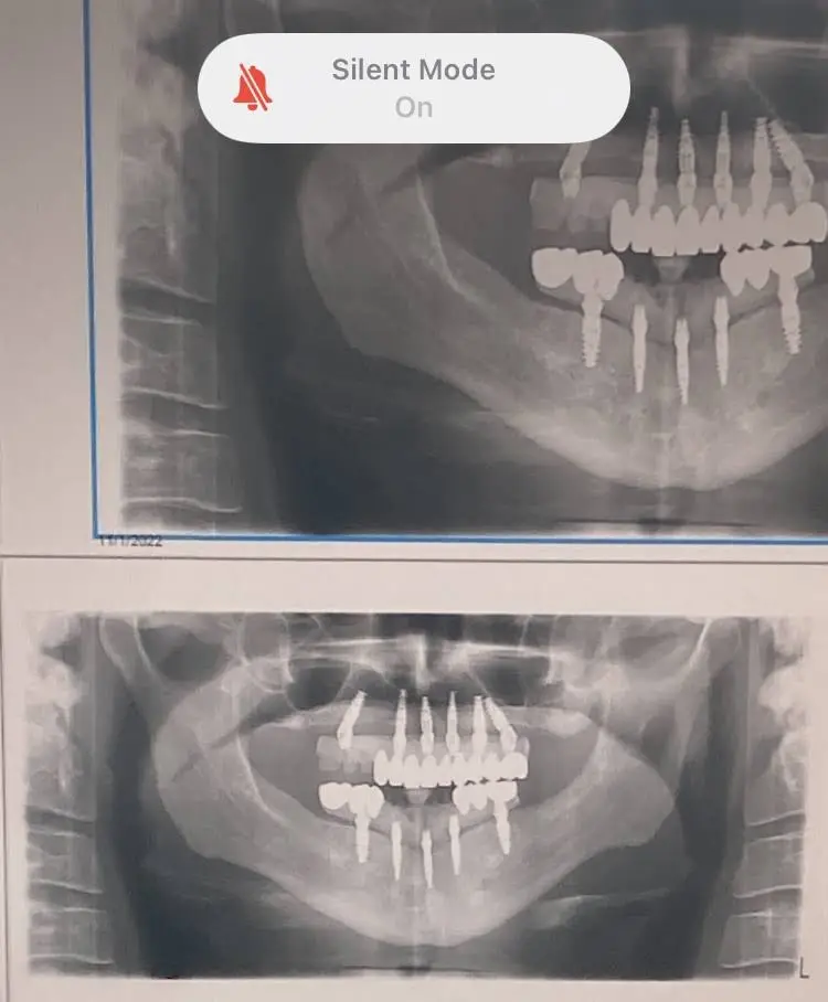 Holden Periodontics and Dental Implants
