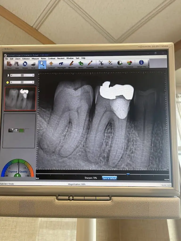 Root Canal Specialists North, PLLC