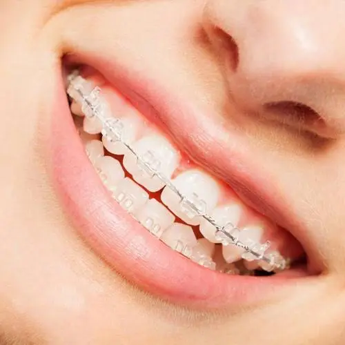 West Family Orthodontics