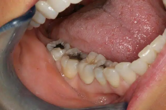 TERAN Dental Co.