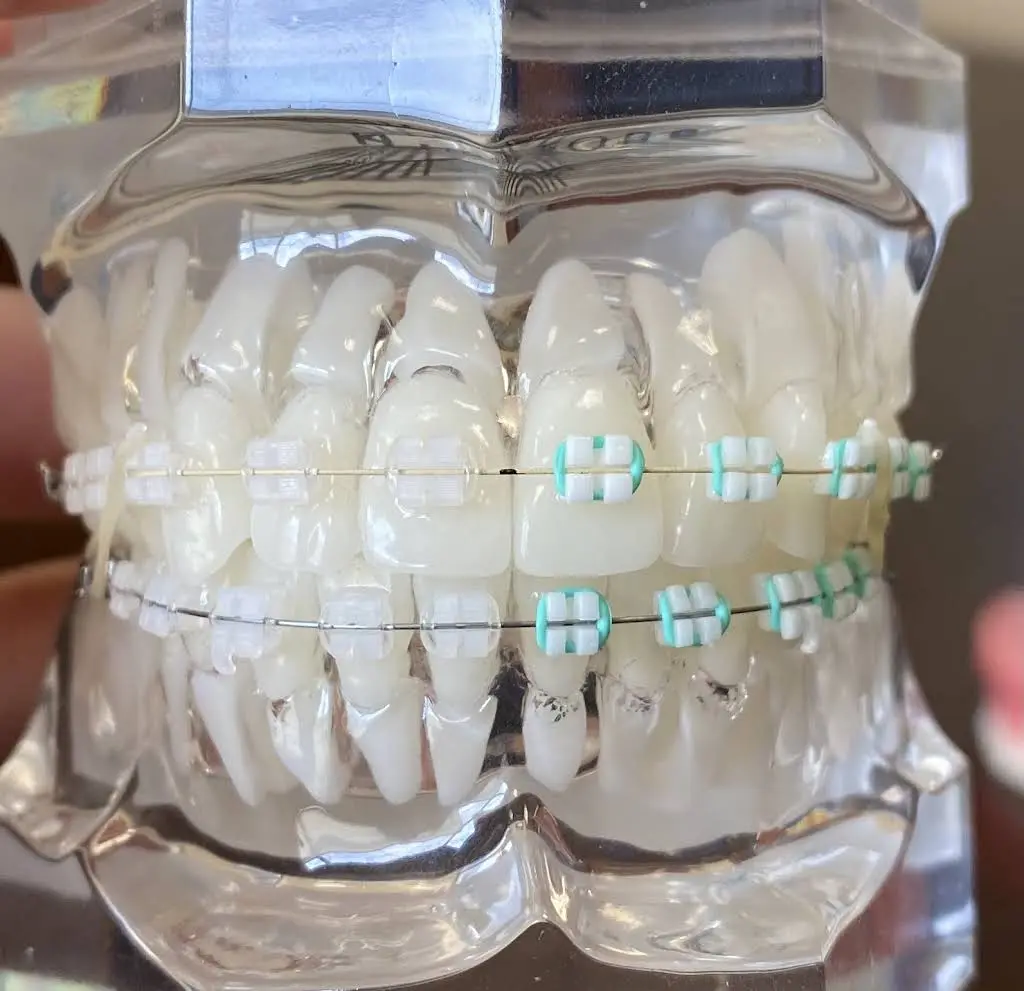Miller Orthodontics