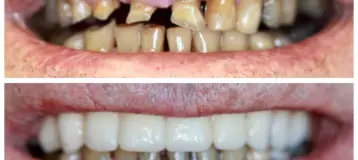 Carroll Family Dentistry