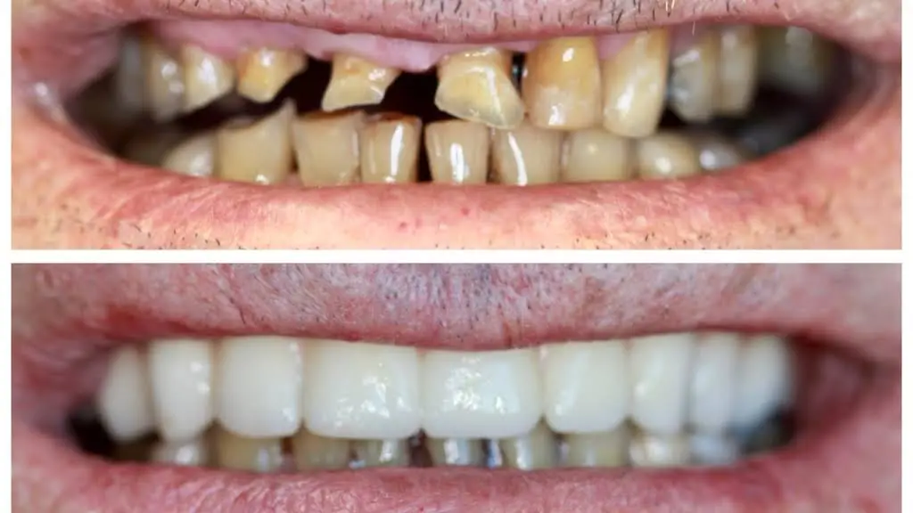 Carroll Family Dentistry