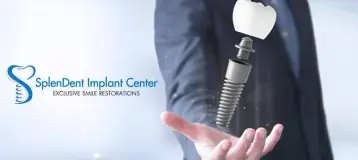 Splendent Implant Center