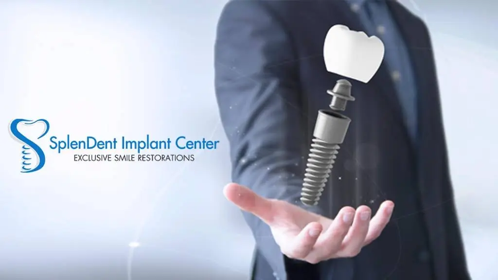 Splendent Implant Center