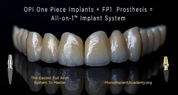 Mono Implant Academy