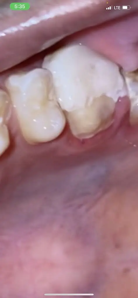 Lindenbrook Dental Care