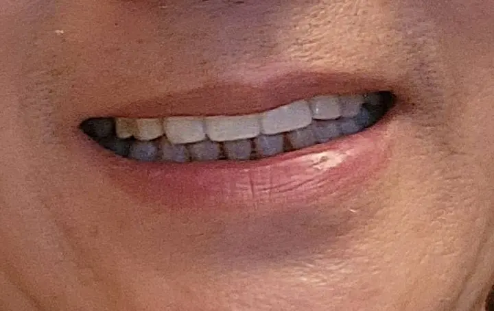 ArtDentistry