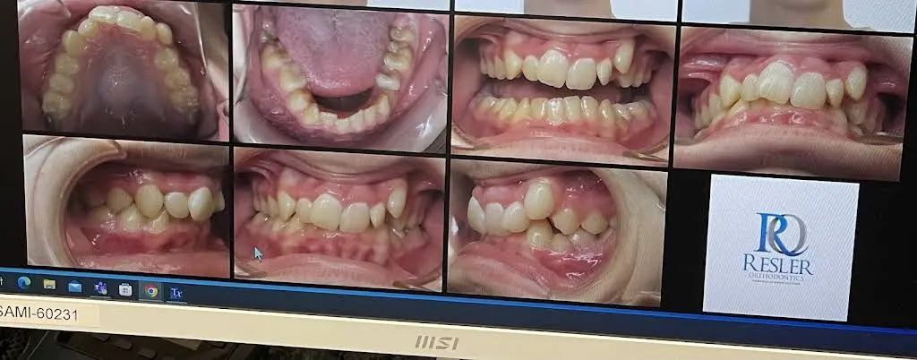 Resler Orthodontics