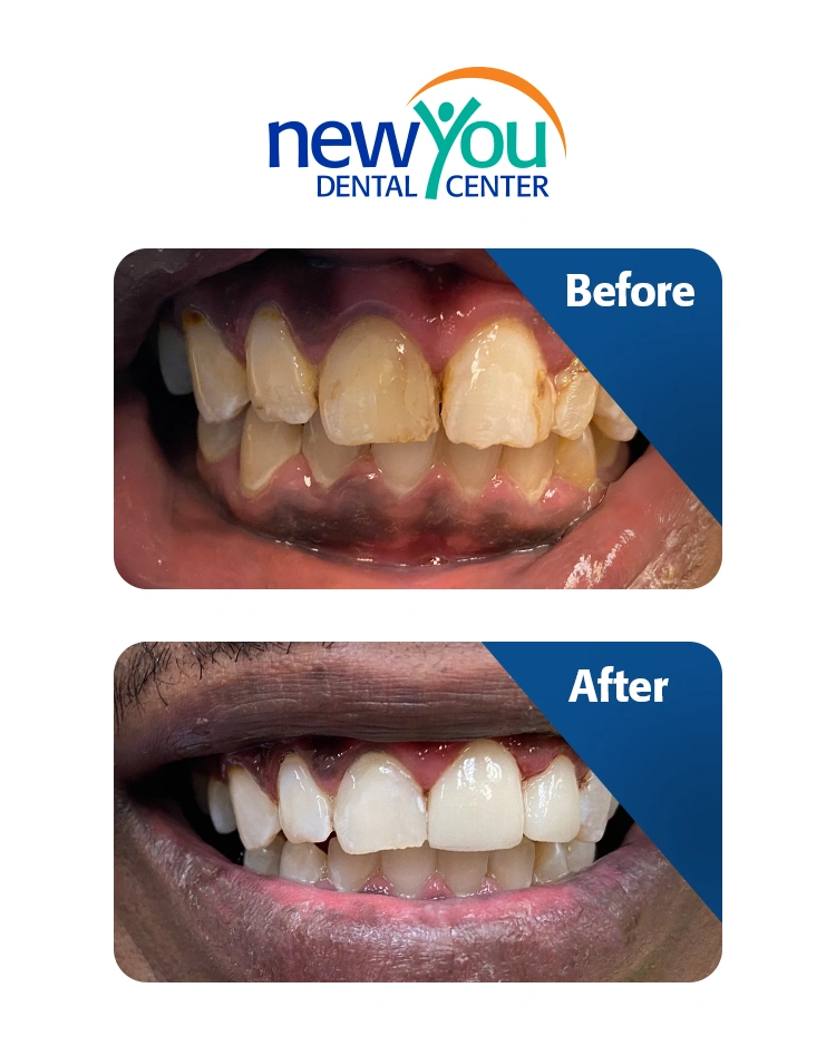 New You Dental Center
