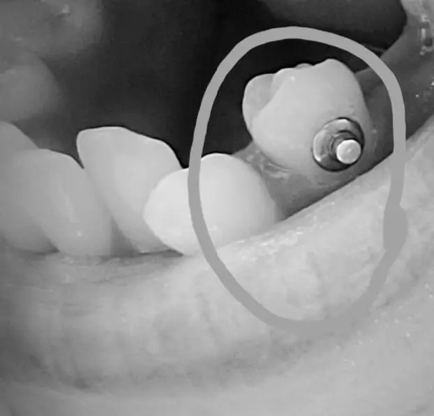 Dyras Dental