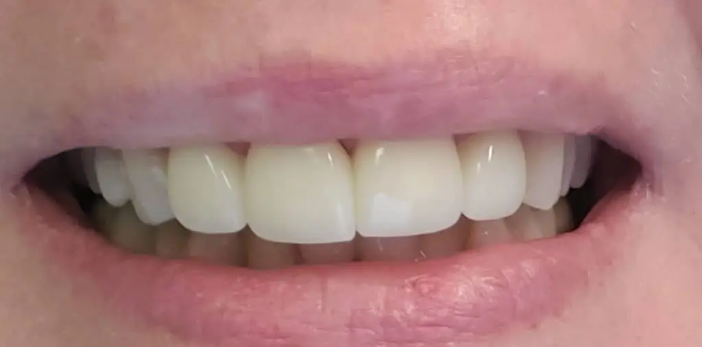 Painless Dentistry - Lansing