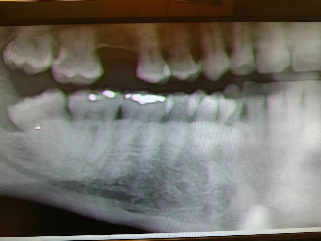 Aspen Dental