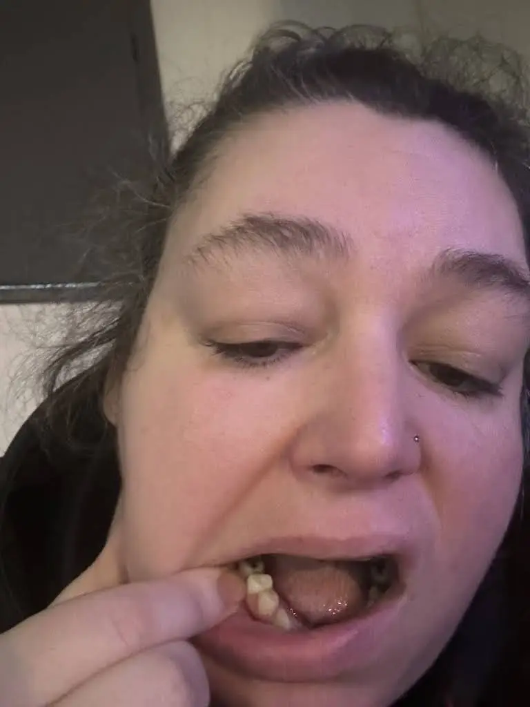 My Community Dental Centers