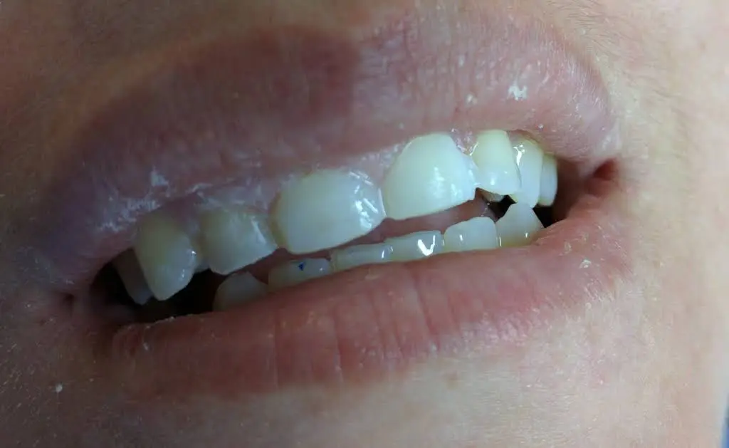 Burton Dental Associates P.C.