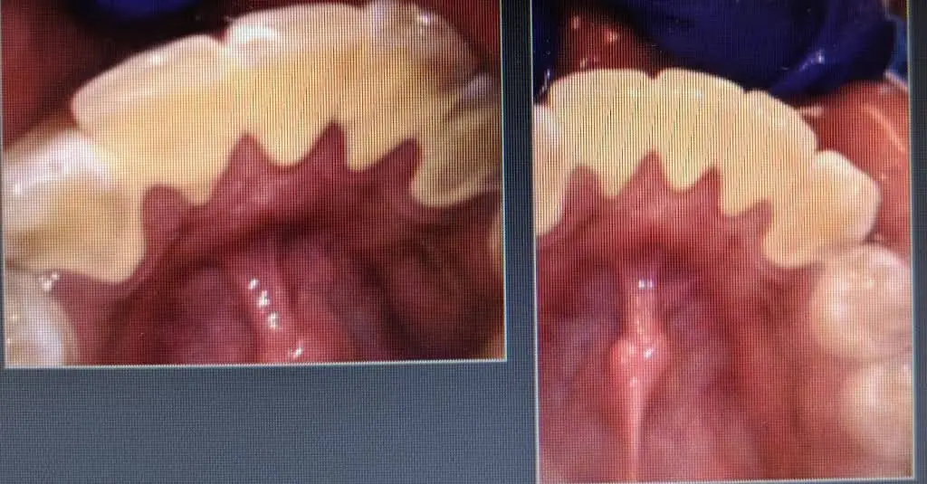 Burton Dental Associates P.C.