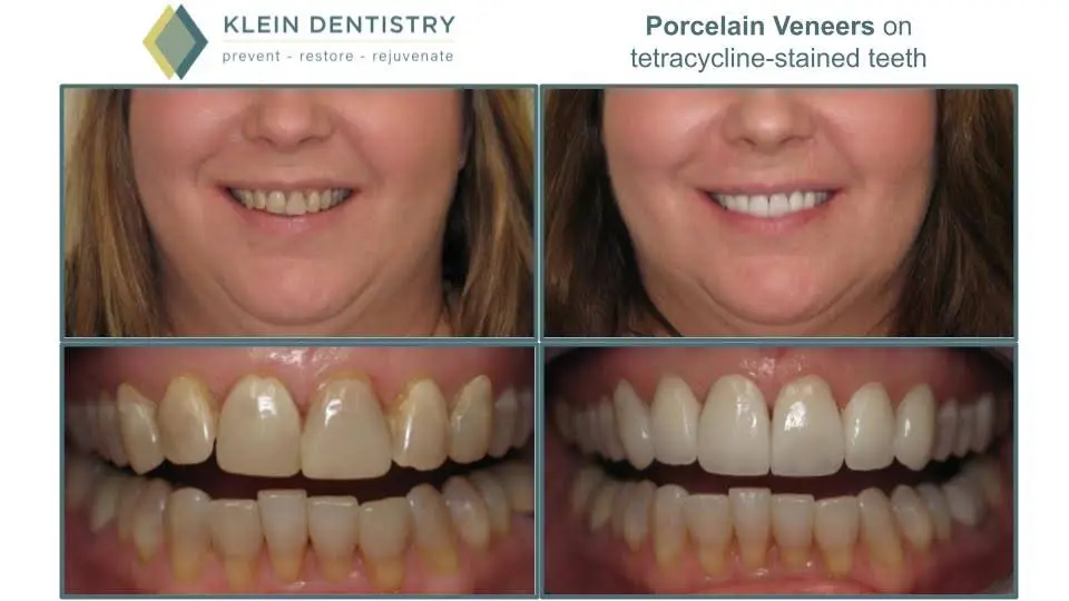 Klein Dentistry
